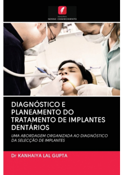 Diagnóstico E Planeamento Do Tratamento De Implantes Dentários