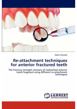Re-attachment techniques for anterior fractured teeth