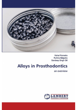 Alloys in Prosthodontics