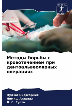 Методы борьбы с кровотечением при дентоальвеолярных операциях