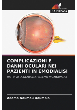 Complicazioni E Danni Oculari Nei Pazienti In Emodialisi