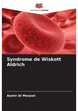Syndrome de Wiskott Aldrich