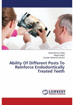 Ability Of Different Posts To Reinforce Endodontically Treated Teeth