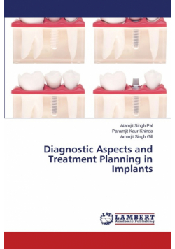 Diagnostic Aspects and Treatment Planning in Implants