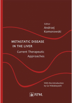 Metastatic Disease in the Liver - Current Therapeutic Approaches