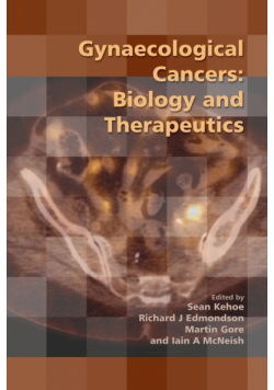 Gynaecological Cancers