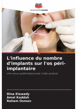 L'influence du nombre d'implants sur l'os péri-implantaire
