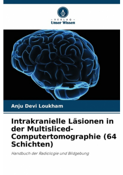 Intrakranielle Läsionen in der Multisliced-Computertomographie (64 Schichten)