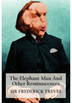 The Elephant Man and Other Reminiscences