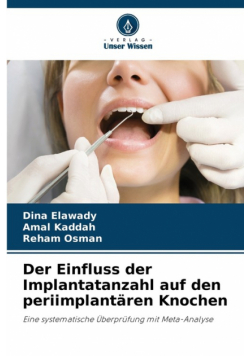 Der Einfluss der Implantatanzahl auf den periimplantären Knochen