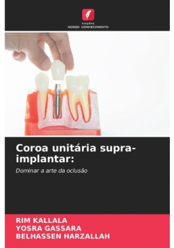 Coroa unitária supra-implantar