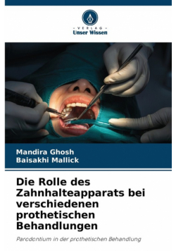 Die Rolle des Zahnhalteapparats bei verschiedenen prothetischen Behandlungen