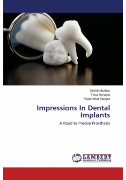 Impressions In Dental Implants