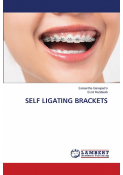 Self Ligating Brackets