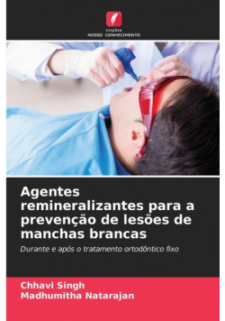 Agentes remineralizantes para a prevenção de lesões de manchas brancas