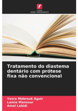 Tratamento do diastema dentário com prótese fixa não convencional