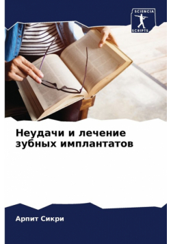 Неудачи и лечение зубных имплантатов