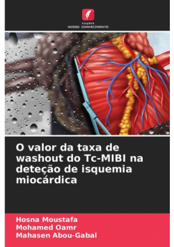 O valor da taxa de washout do Tc-MIBI na deteção de isquemia miocárdica