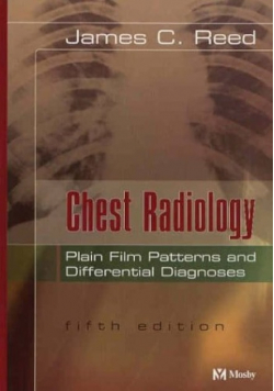 Chest Radiology Plain Film Patterns and Differential Diagnoses