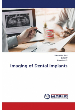 Imaging of Dental Implants