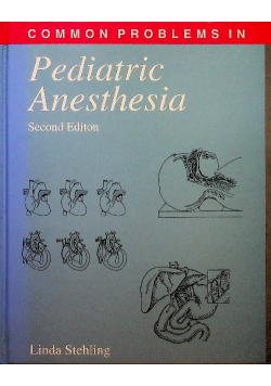 Pediatric anesthesia