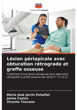 Lésion périapicale avec obturation rétrograde et greffe osseuse