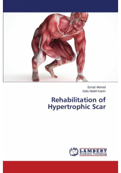 Rehabilitation of Hypertrophic Scar