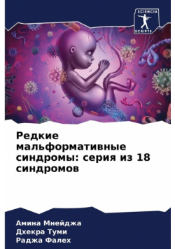 Редкие мальформативные синдромы
