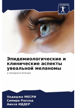 Эпидемиологические и клинические аспекты увеальной меланомы