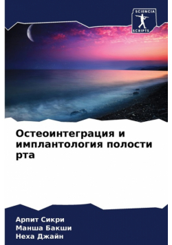 Остеоинтеграция и имплантология полости рта