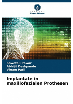 Implantate in maxillofazialen Prothesen