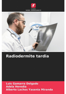 Radiodermite tardia