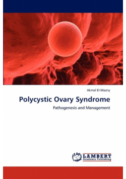 Polycystic Ovary Syndrome