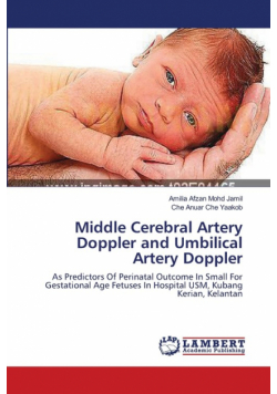 Middle Cerebral Artery Doppler and Umbilical Artery Doppler