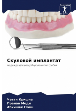 Скуловой имплантат