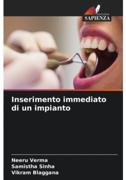 Inserimento immediato di un impianto