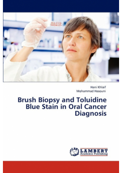 Brush Biopsy and Toluidine Blue Stain in Oral Cancer Diagnosis