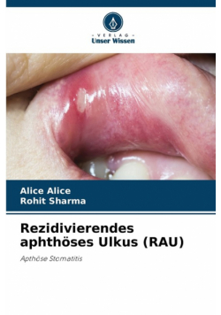 Rezidivierendes aphthöses Ulkus (RAU)
