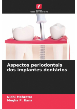 Aspectos periodontais dos implantes dentários