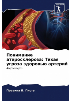 Понимание атеросклероза