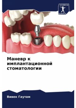Маневр к имплантационной стоматологии