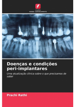 Doenças e condições peri-implantares