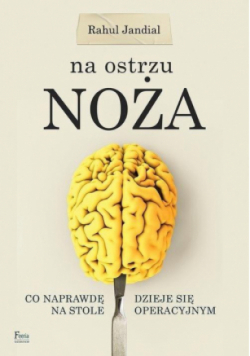 Na ostrzu noża Co naprawdę dzieje na na stole operacyjnym
