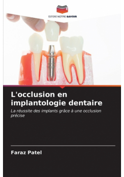 L'occlusion en implantologie dentaire
