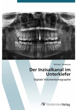 Der Inzisalkanal im Unterkiefer