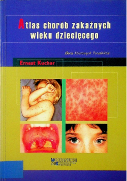 Atlas chorób zakaźnych wieku dziecięcego