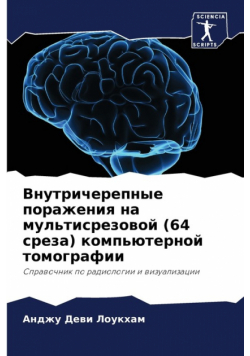 Внутричерепные поражения на мультисрезовой (64 среза) компьютерной томографии