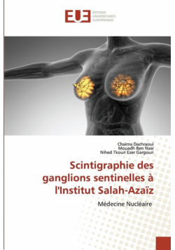 Scintigraphie des ganglions sentinelles à l'Institut Salah-Azaïz