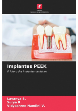 Implantes PEEK