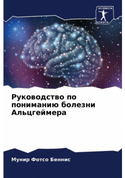 Руководство по пониманию болезни Альцгеймера